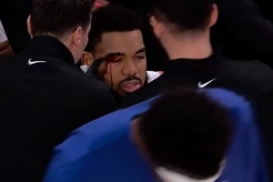 血溅赛场！唐斯突破对抗斯潘塞·琼斯双双流血 唐斯眉骨被撞破